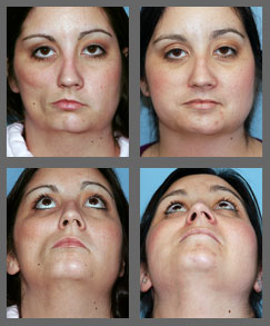 Lipostructure- Skin & Vein Center, MI