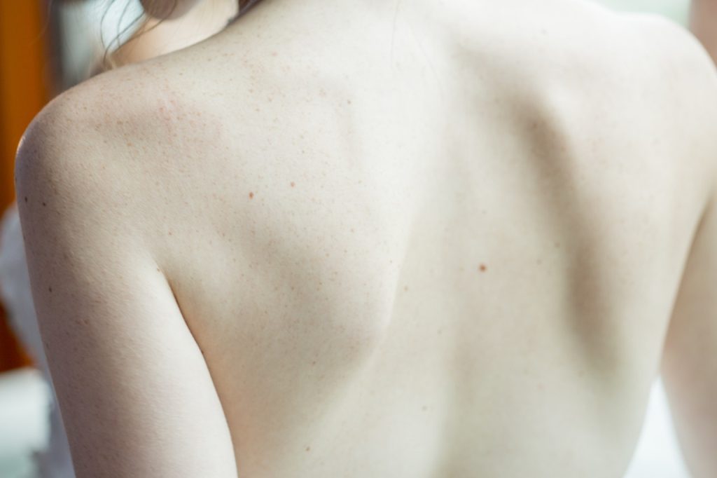 skin protection