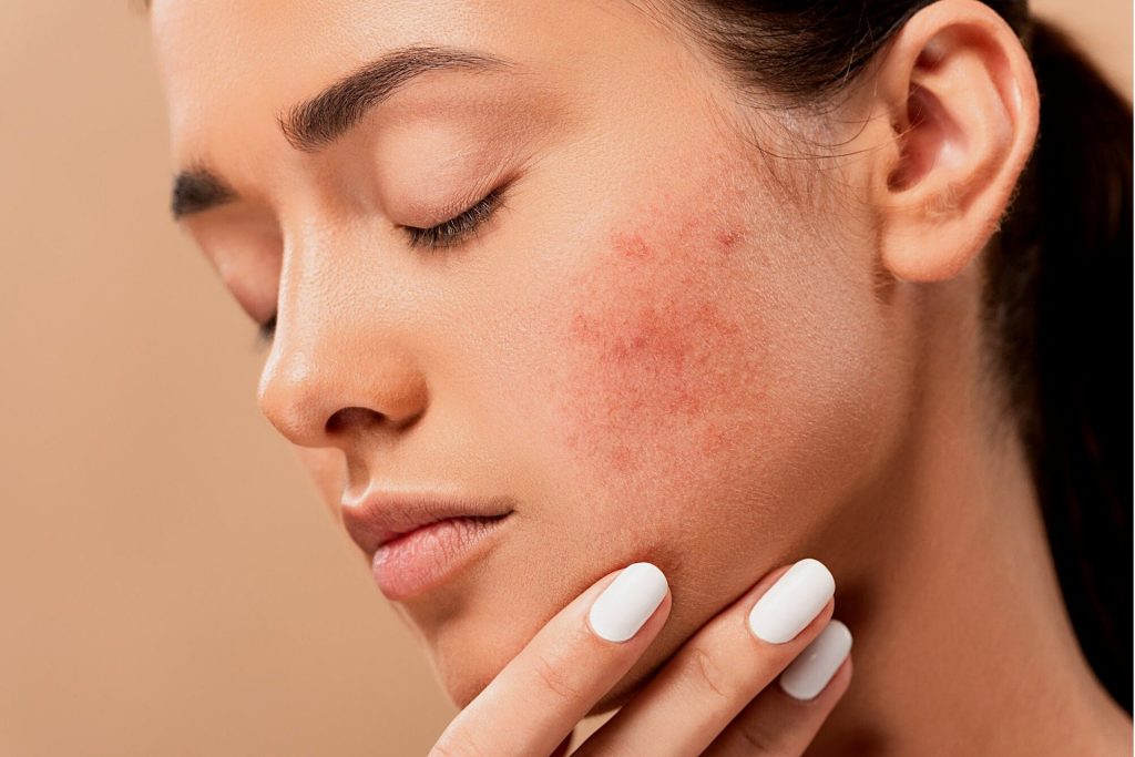 woman with red on the side of her cheek