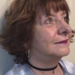 Facelift Before & After Patient #7447