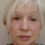 Facelift Before & After Patient #7448