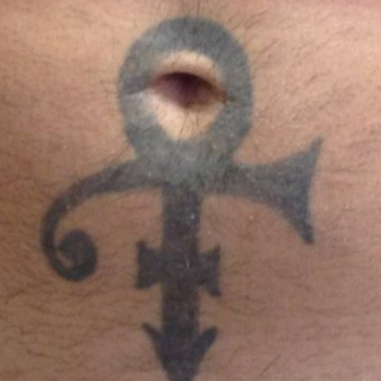 Tattoo Removal Before & After Patient #10112