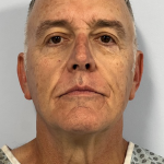 HourLift Before & After Patient #10582