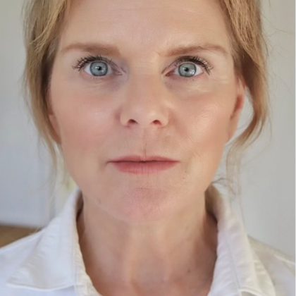 HourLift Before & After Patient #10713